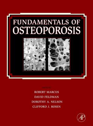 Cover of the book Fundamentals of Osteoporosis by Rossen Donev