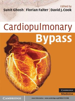 Cover of the book Cardiopulmonary Bypass by J. W. Van Ooijen, J. Jansen