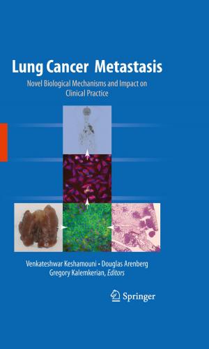 Cover of the book Lung Cancer Metastasis by Bob Weinstein, Lt. Colonel, US Army, Ret.