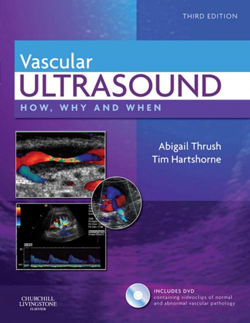 Cover of the book Vascular Ultrasound E-Book by Abigail Thrush, Timothy Hartshorne, HND in Biology, Elsevier Health Sciences