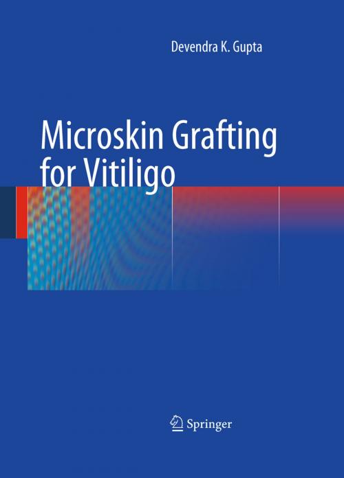 Cover of the book Microskin Grafting for Vitiligo by Devendra K. Gupta, Springer London