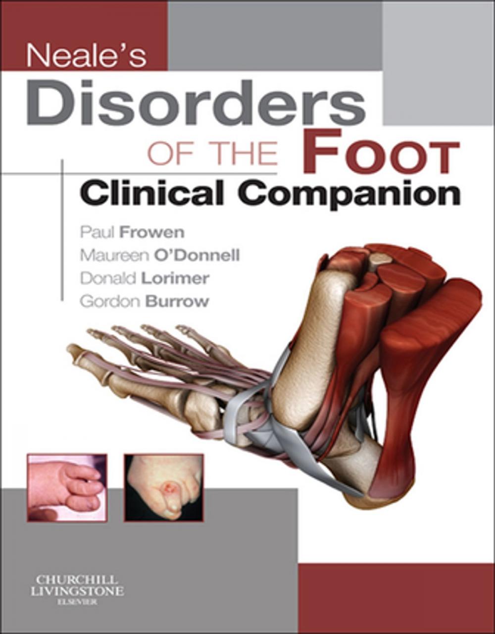 Big bigCover of Neale's Disorders of the Foot