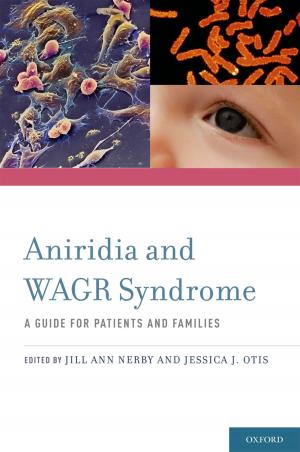 Cover of the book Aniridia and WAGR Syndrome by Elizabeth Fenton