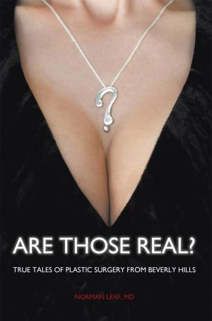Cover of Are Those Real?