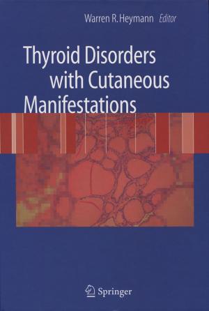 Cover of the book Thyroid Disorders with Cutaneous Manifestations by P. Beighton, H. G. Jacobson, B. J. Cremin
