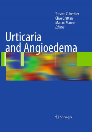 Cover of the book Urticaria and Angioedema by P. Alken, D. Bach, C. Chaussy, R. Hautmann, F. Hering, W. Lutzeyer, M. Marberger, E. Schmied, H.-J. Schneider, W. Stackl