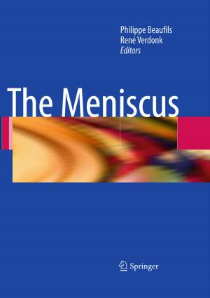 Cover of the book The Meniscus by W. Alberti, K.K Aug, W. Calvo, W. Gössner, H. Grosse-Wilde, T. Herrmann, F. Heuck, J.W. Hopewell, L. Keilholz, A. Keyeux, J. Kummermehr, H.-A. Ladner, A. Luz, M. Molls, W. Nothdurft, H.S. Reinhold, H. Reyners, R. Sauer, U. Schaefer, E.W. Scherer, T.E. Schultheiss, S. Schultz-Hector, L.C. Stephens, F.A. Stewart, M. Stuschke, K.-R. Trott, D. van Beuningen, A.J. van der Kogel, M.V. Williams, C. Streffer