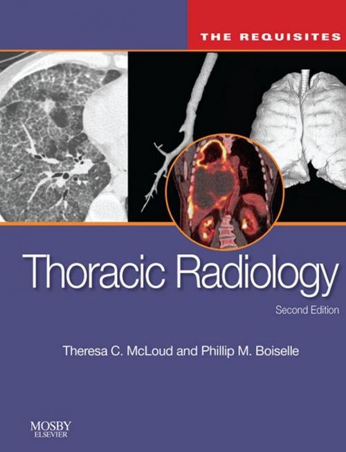 Cover of the book Thoracic Radiology: The Requisites E-Book by Theresa C. McLoud, MD, Elsevier Health Sciences