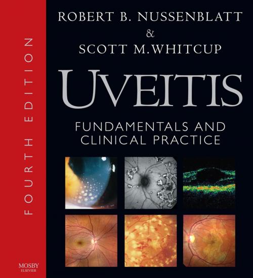 Cover of the book Uveitis E-Book by Robert B. Nussenblatt, MD, Scott M. Whitcup, MD, Elsevier Health Sciences