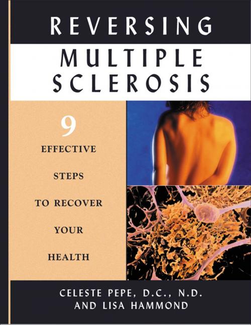 Cover of the book Reversing Multiple Sclerosis: 9 Effective Steps to Recover Your Health by Pepe, Celeste; Hammond, Lisa, Hampton Roads Publishing
