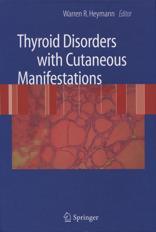 Cover of the book Thyroid Disorders with Cutaneous Manifestations by , Springer London