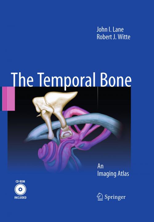 Cover of the book Temporal Bone by John I. Lane, Robert J. Witte, Springer Berlin Heidelberg