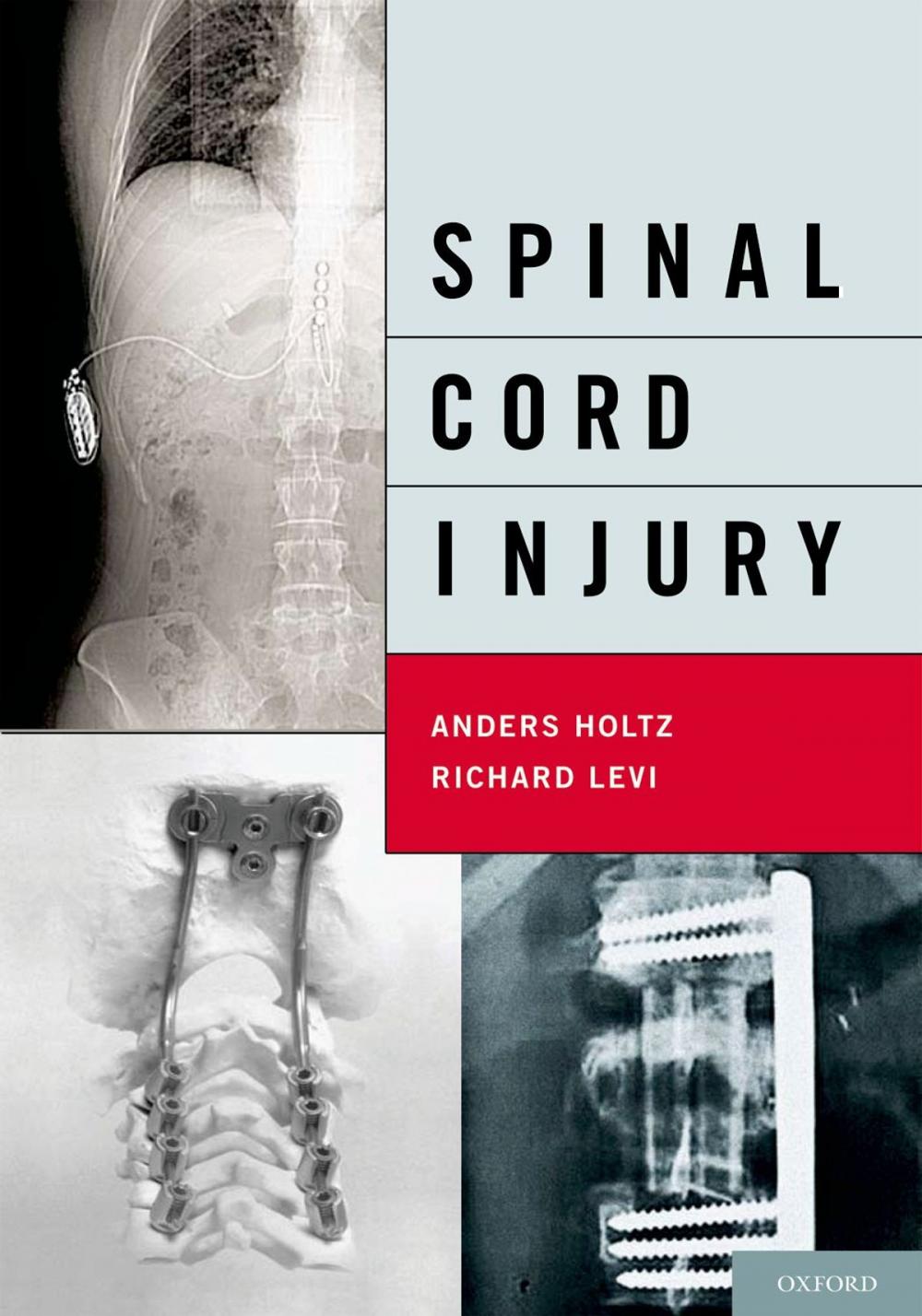 Big bigCover of Spinal Cord Injury