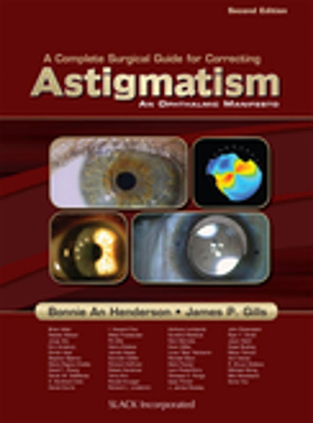 Big bigCover of A Complete Surgical Guide for Correcting Astigmatism