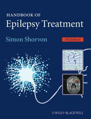 Cover of the book Handbook of Epilepsy Treatment by David Huddart, Tim Stott