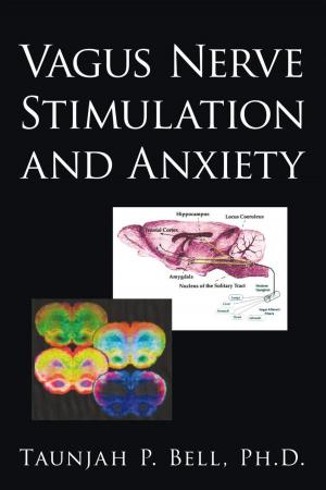 Cover of the book Vagus Nerve Stimulation and Anxiety by American Association of Nurse Life Care Planners