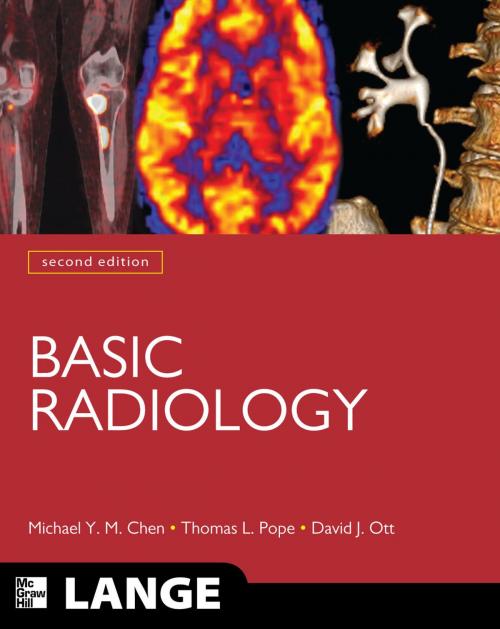 Cover of the book Basic Radiology, Second Edition by Michael Y.M. Chen, Thomas L. Pope, David J. Ott, McGraw-Hill Education