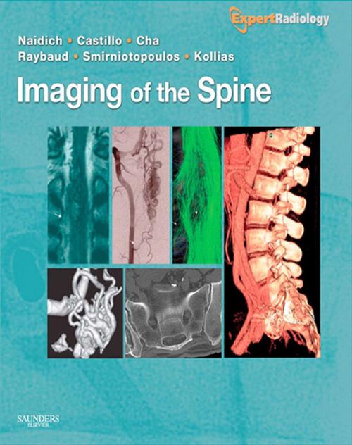 Cover of the book Imaging of the Spine E-Book by Thomas P. Naidich, MD, Mauricio Castillo, MD, Soonmee Cha, MD, Charles Raybaud, MD, James G. Smirniotopoulos, MD, Spyros Kollias, Elsevier Health Sciences