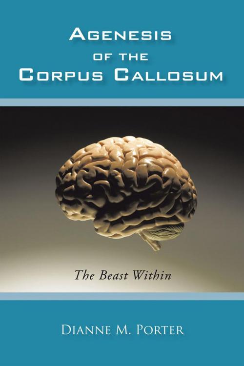 Cover of the book Agenesis of the Corpus Callosum by Dianne M. Porter, iUniverse