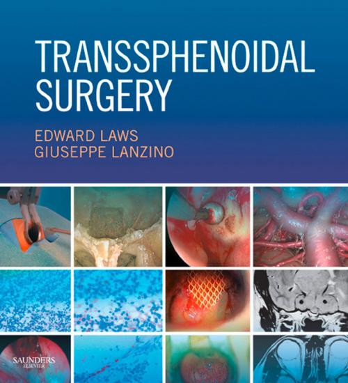 Cover of the book Transsphenoidal Surgery E-Book by Edward R. Laws Jr, MD, FACS, Giuseppe Lanzino, MD, Elsevier Health Sciences