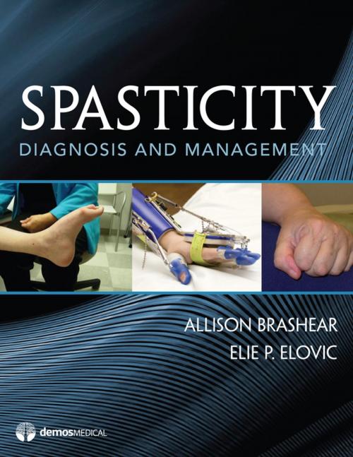 Cover of the book Spasticity by Elie Elovic, MD, Springer Publishing Company