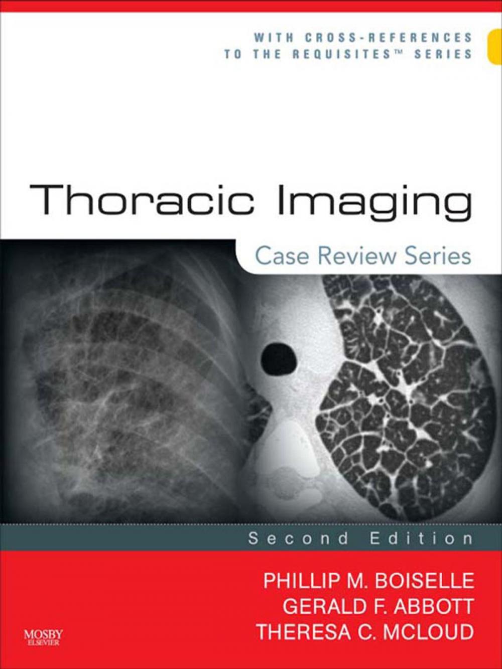 Big bigCover of Thoracic Imaging: Case Review Series E-Book