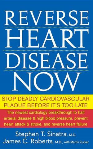 Book cover of Reverse Heart Disease Now