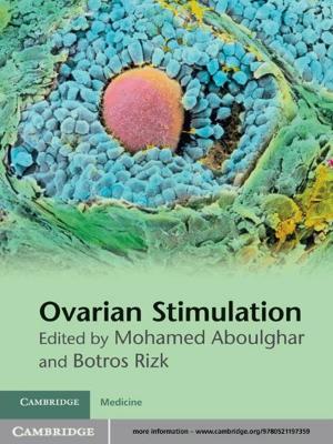 Cover of the book Ovarian Stimulation by Lucas Bergkamp, Michael Faure, Monika Hinteregger, Niels Philipsen