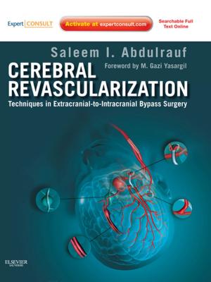 Book cover of Cerebral Revascularization - E-Book