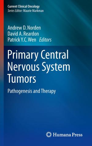 Cover of the book Primary Central Nervous System Tumors by Melanie Johns Cupp