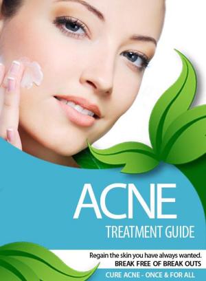 Cover of the book ACNE TREATMENT GUIDE by Kenneth Silvestri