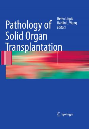 Cover of the book Pathology of Solid Organ Transplantation by Joan Shenton