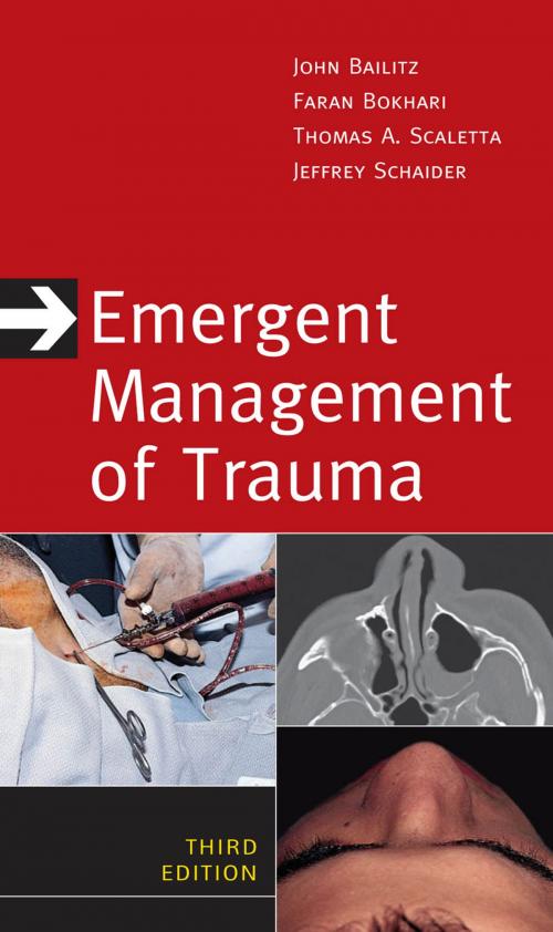 Cover of the book Emergent Management of Trauma, Third Edition by John Bailitz, Faran Bokhari, Thomas A. Scaletta, Jeffrey J. Schaider, McGraw-Hill Education