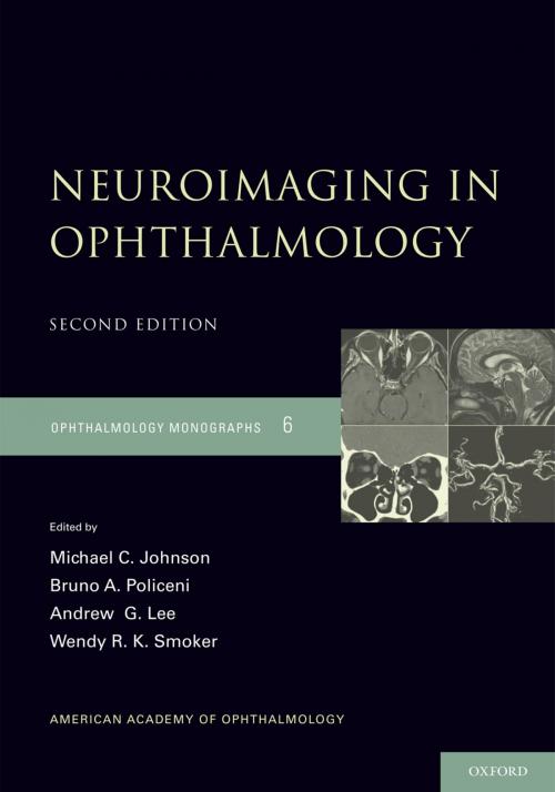 Cover of the book Neuroimaging in Ophthalmology by Michael C. Johnson, Bruno Policeni, Andrew G. Lee, Wendy R.K. Smoker, Oxford University Press