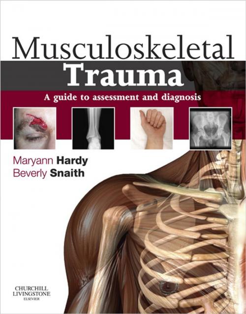 Cover of the book Musculoskeletal Trauma E-Book by Maryann Hardy, Beverly Snaith, Elsevier Health Sciences