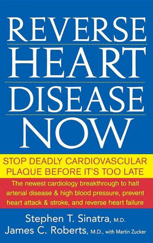 Cover of the book Reverse Heart Disease Now by Stephen T. Sinatra M.D., James C. Roberts M.D., Turner Publishing Co.