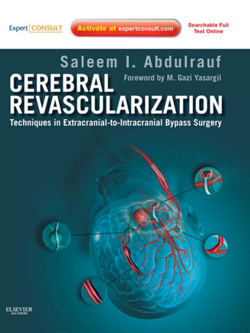 Cover of the book Cerebral Revascularization - E-Book by Saleem I. Abdulrauf, MD, FAAN, FACS, Elsevier Health Sciences