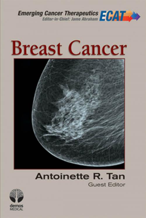 Cover of the book Breast Cancer: ECT V1 I 3 by Antoinette R. Tan, MD, MHSc, Springer Publishing Company