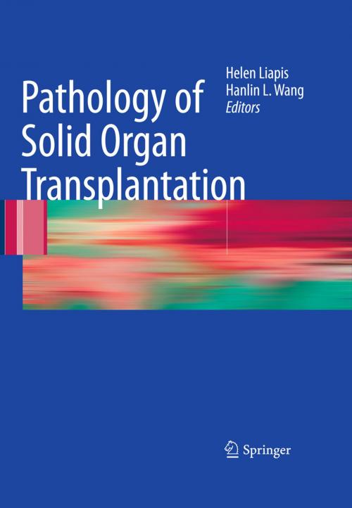 Cover of the book Pathology of Solid Organ Transplantation by , Springer Berlin Heidelberg