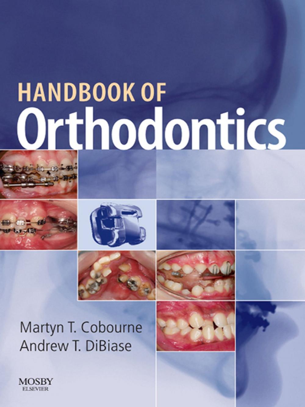 Big bigCover of Handbook of Orthodontics