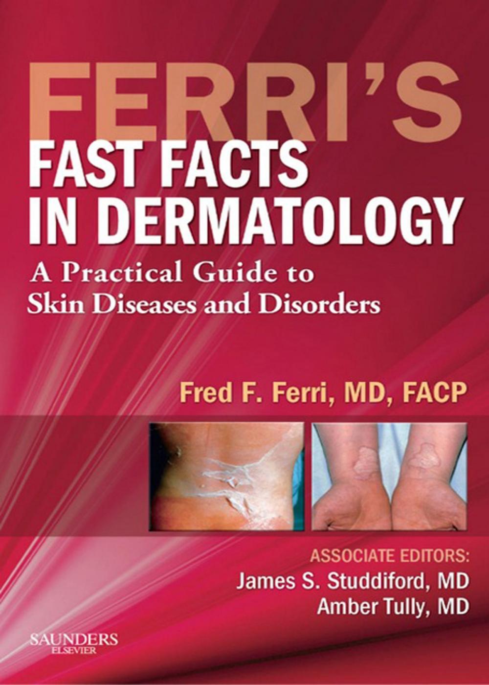 Big bigCover of Ferri's Fast Facts in Dermatology E-Book