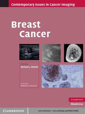Cover of the book Breast Cancer by B. A. Davey, H. A. Priestley