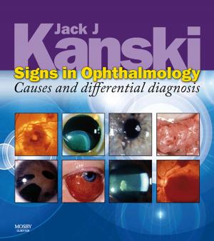 Book cover of Signs in Ophthalmology: Causes and Differential Diagnosis