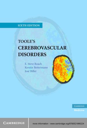 Cover of the book Toole's Cerebrovascular Disorders by Peter Stamatov