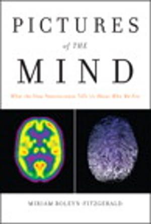 bigCover of the book Pictures of the Mind: What the New Neuroscience Tells Us About Who We Are by 