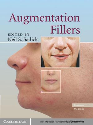 Cover of the book Augmentation Fillers by David Marshall Miller