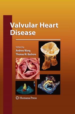 Cover of the book Valvular Heart Disease by David Naor, Benjamin Y. Klein, Nora Tarcic, Jonathan S. Duke-Cohan