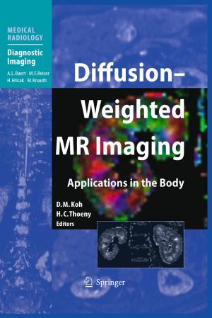 Cover of the book Diffusion-Weighted MR Imaging by G. Guntern