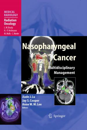 Cover of the book Nasopharyngeal Cancer by Shunzhong Liu