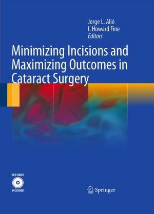 Cover of the book Minimizing Incisions and Maximizing Outcomes in Cataract Surgery by Martin Schulz, Oliver Wasmeier